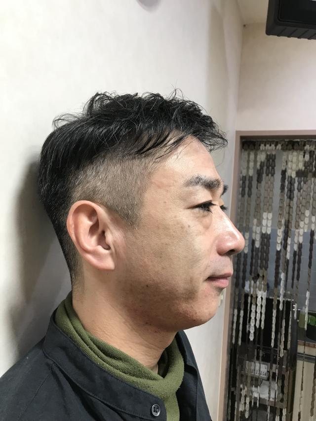 iga
