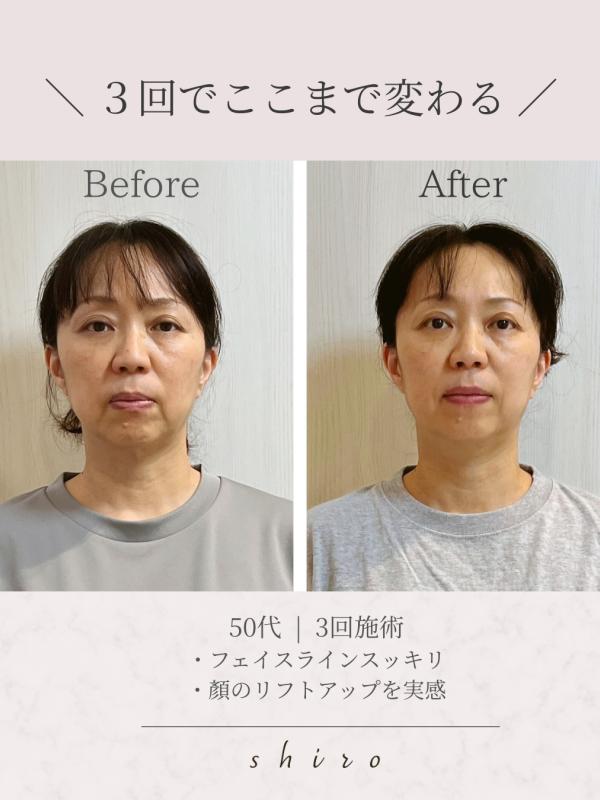 のヘアカタログ画像